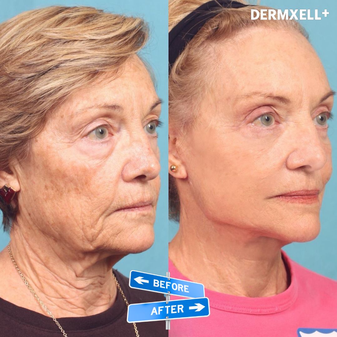 Age Defying Lift & Firm Cream (AfterSell Special Discount)