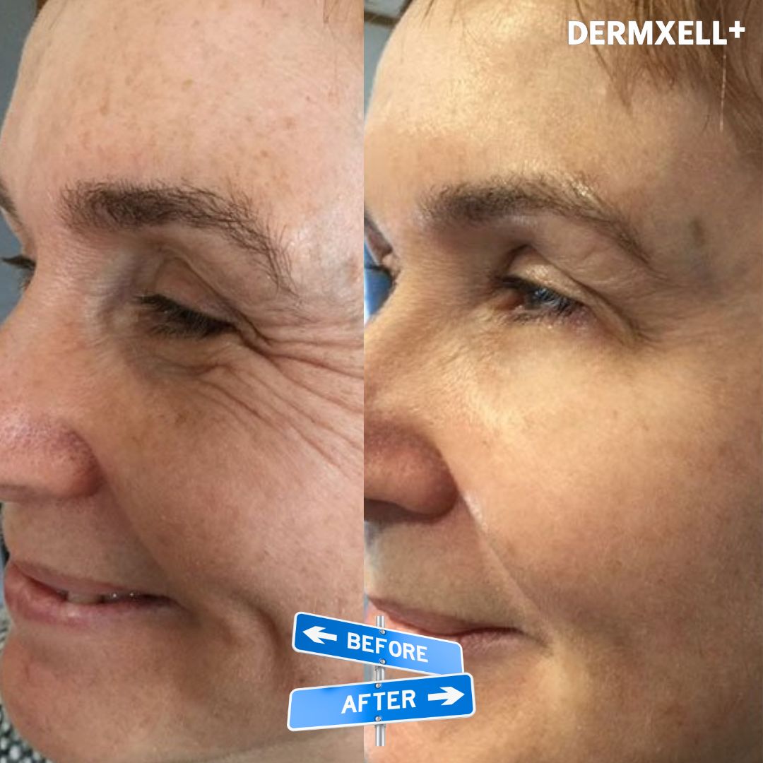 Age Defying Lift & Firm Cream (AfterSell Special Discount)