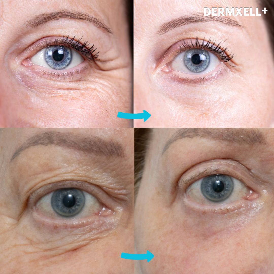 Instant Lift & Brighten Peptide Eye Serum (AfterSell Special Discount)
