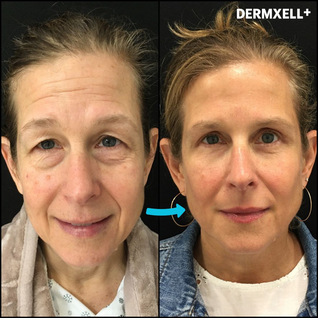 Midnight Miracle Peptide-Retinol Eye Lift Serum (AfterSell Special Discount)