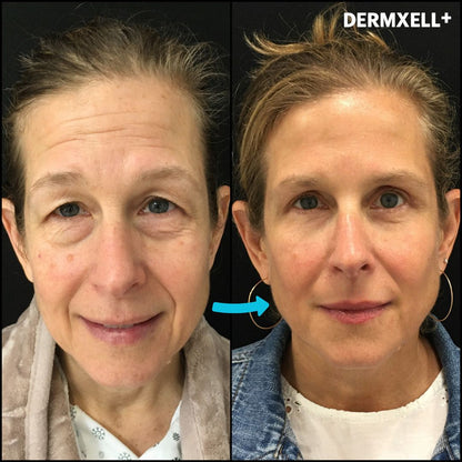 Midnight Miracle Peptide-Retinol Eye Lift Serum (AfterSell Special Discount)