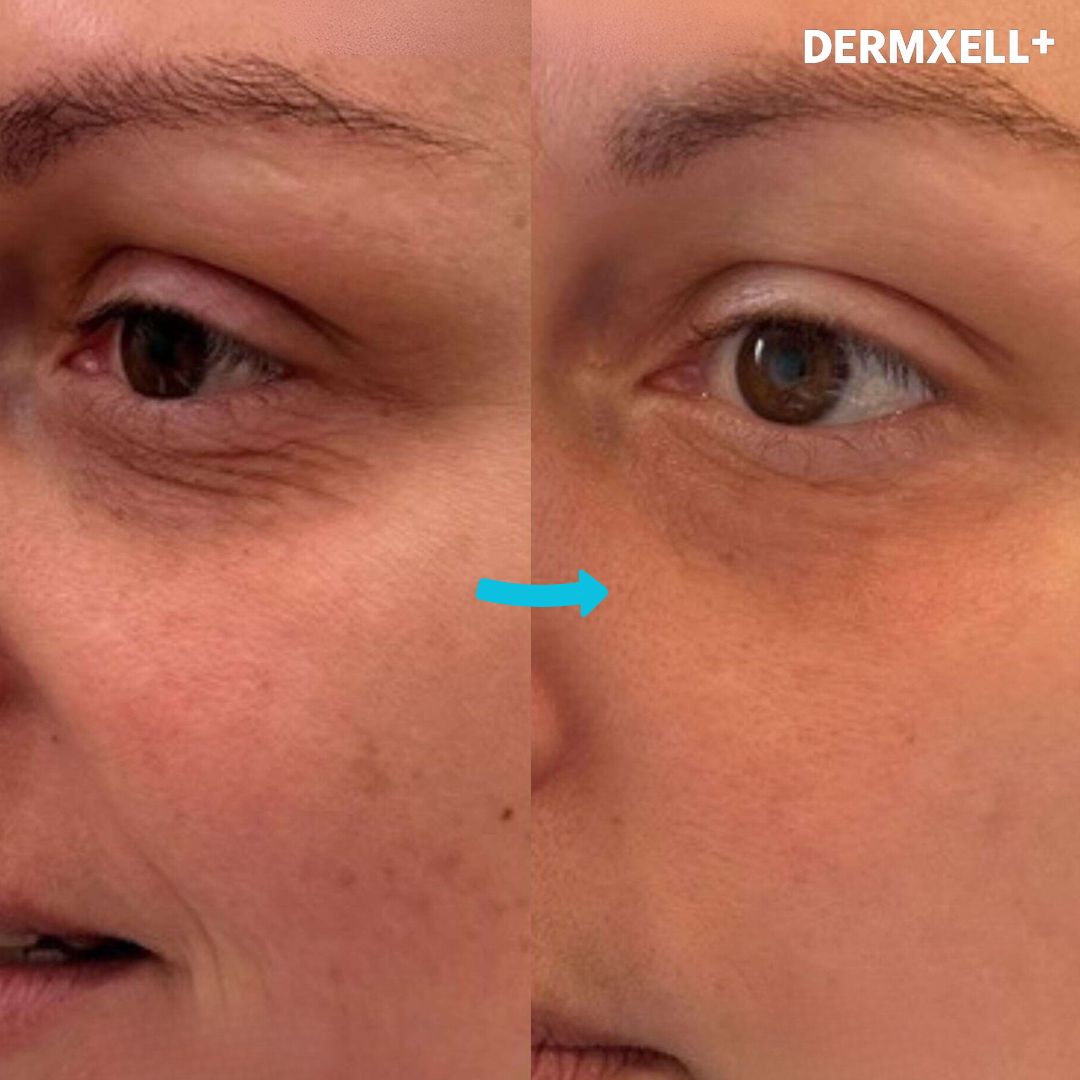 Instant Lift & Brighten Peptide Eye Serum (AfterSell Special Discount)