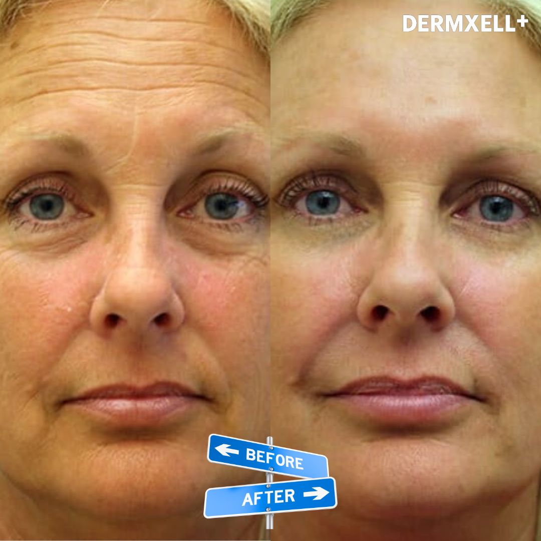 Age Defying Lift & Firm Cream (AfterSell Special Discount)