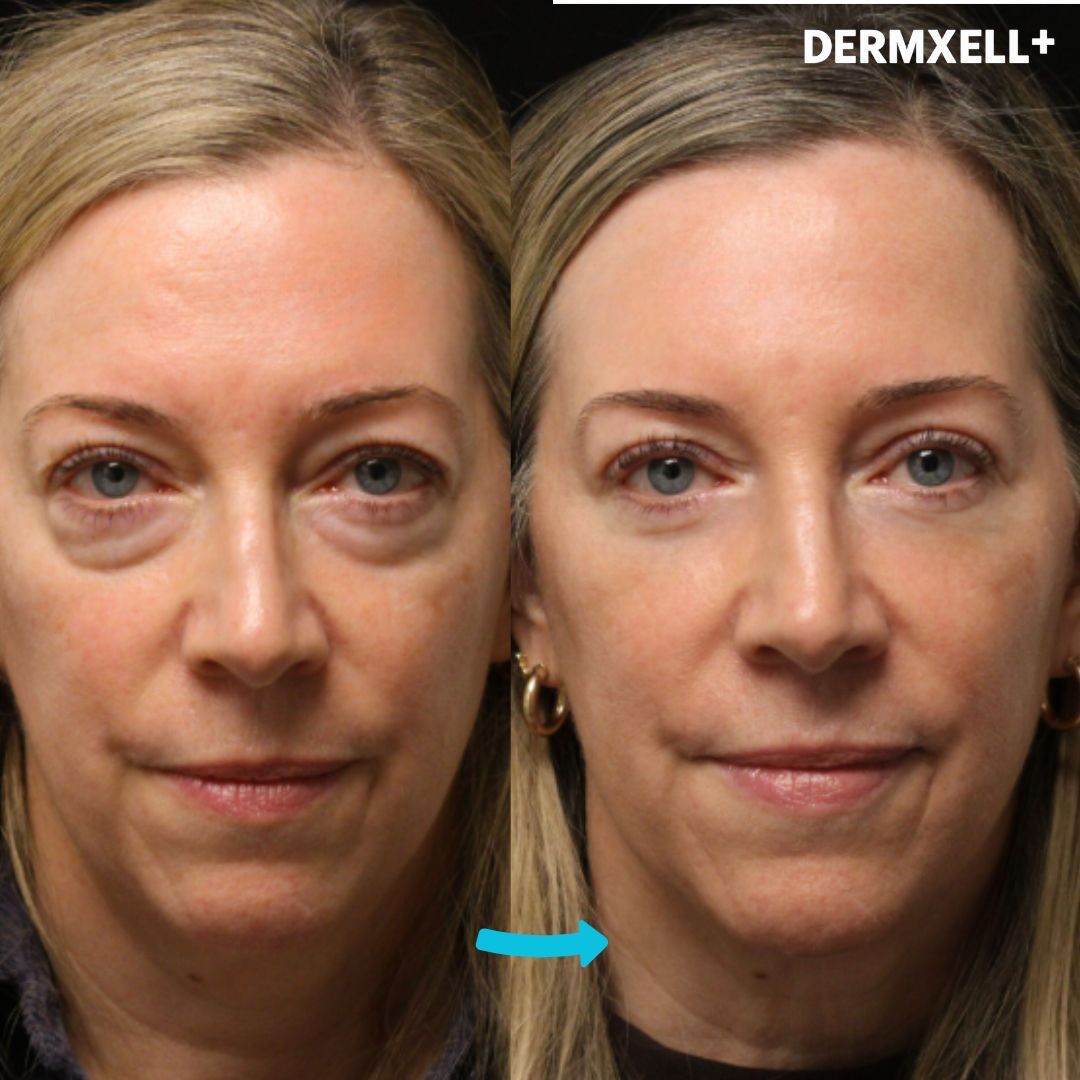 Instant Lift & Brighten Peptide Eye Serum (AfterSell Special Discount)