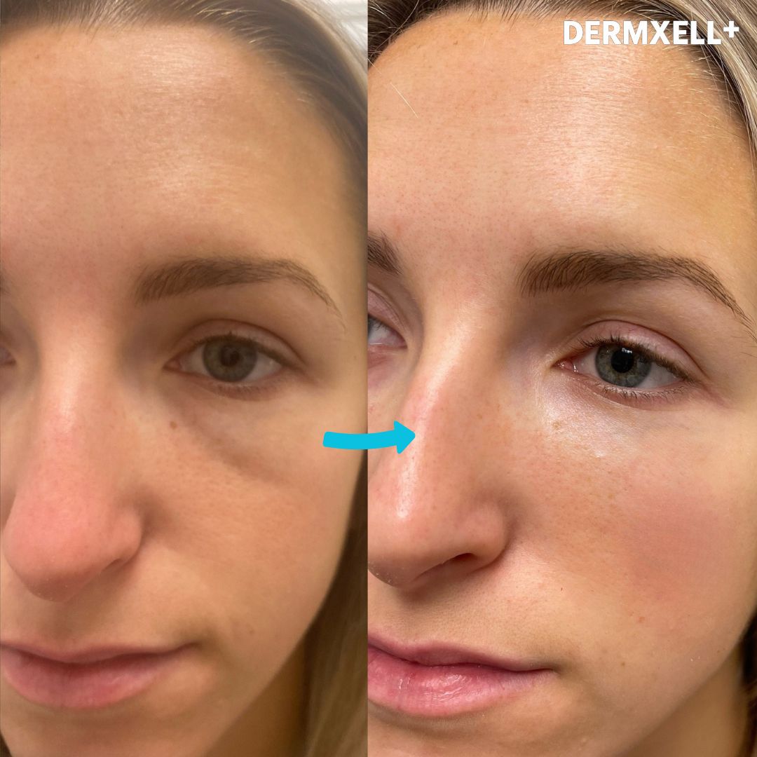 Instant Lift & Brighten Peptide Eye Serum (AfterSell Special Discount)