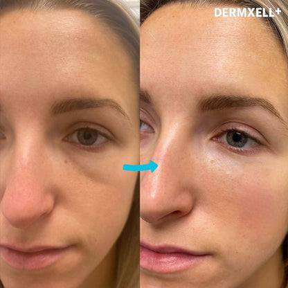 Instant Lift & Brighten Peptide Eye Serum (AfterSell Special Discount)