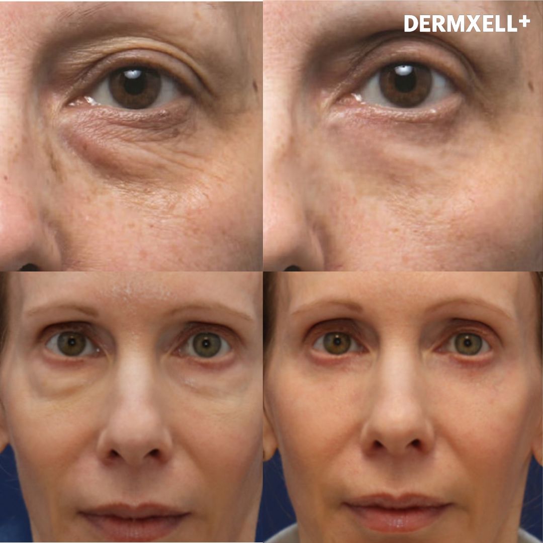 Midnight Miracle Peptide-Retinol Eye Lift Serum (AfterSell Special Discount)