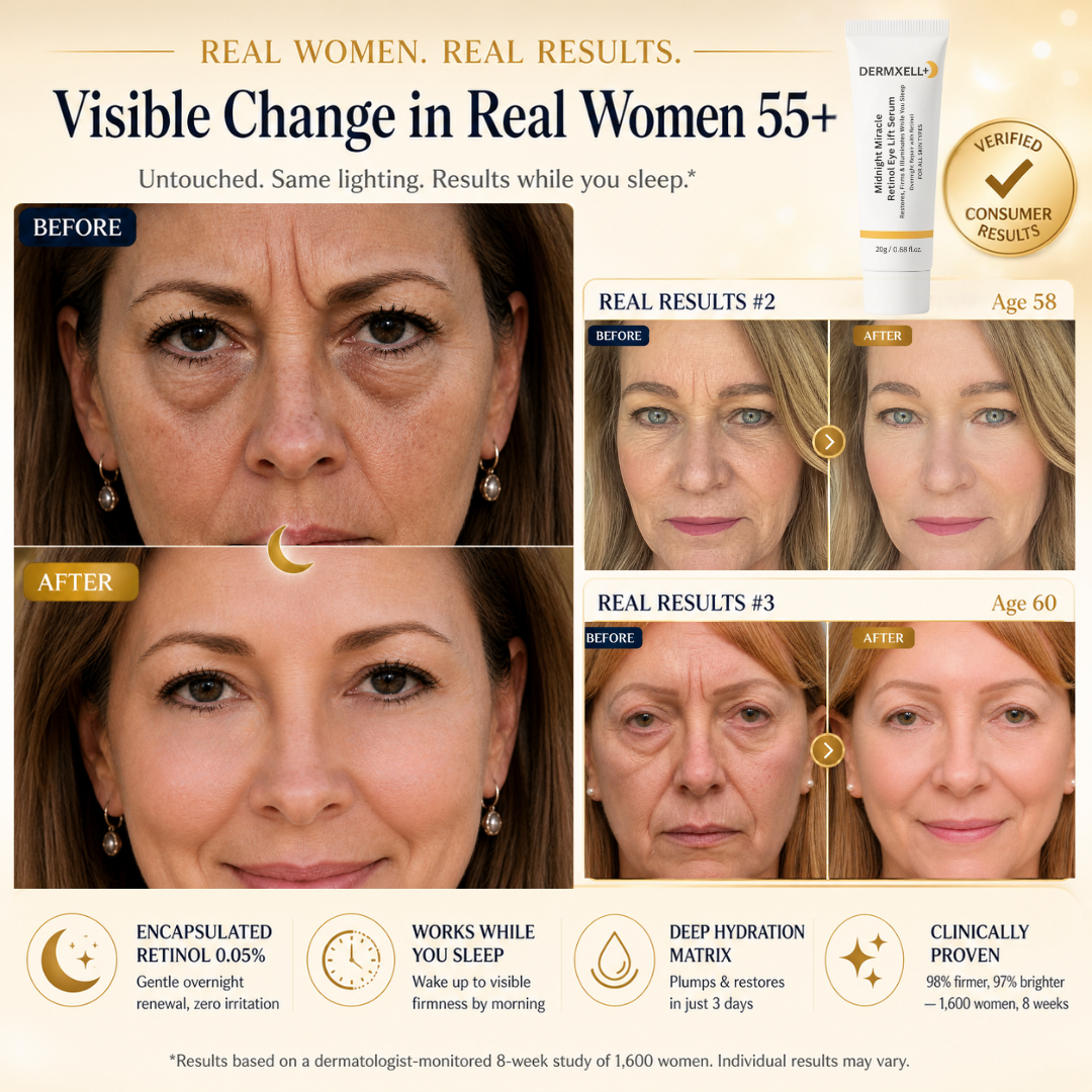 Midnight Miracle Retinol Eye Lift Serum – Dermxell